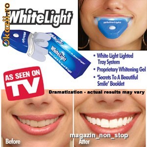 Aparatul de albit dintii -- WhiteLight Tooth Vazut La TV foto mare
